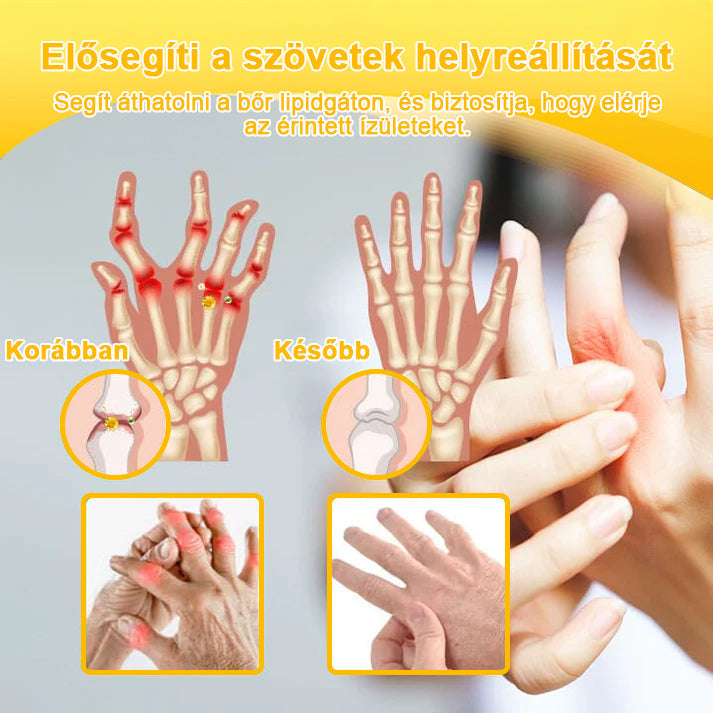 💧🐝TLOPA® Botulinum Toxin & Méhméreg Fájdalomcsillapító Csontgyógyító Krém👨⚕️A Magyar Ortopéd Társaság (MOT) Által Jóváhagyva