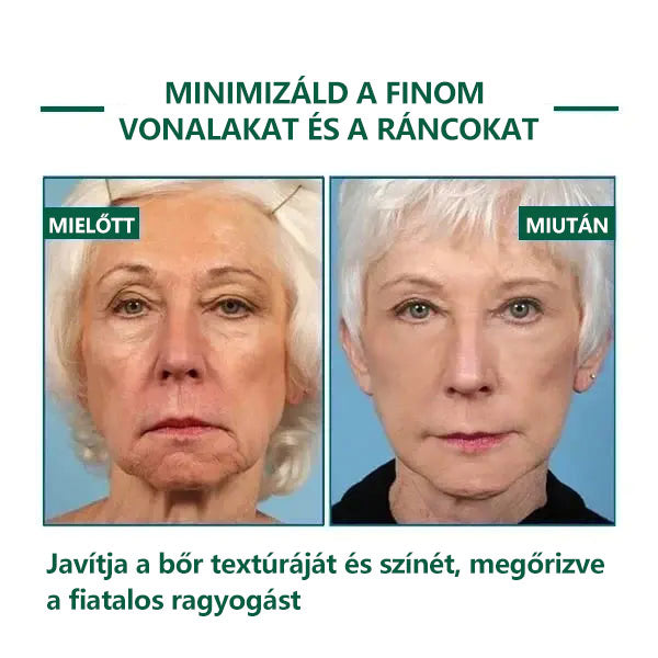 🌿💝A 60%-os akció utolsó napja - Fubsta™ öregedésgátló bőrfeszesítő szérum🔥