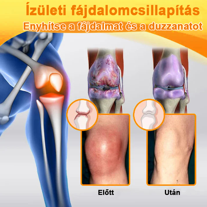 â
Hivatalos ĂruhĂĄz: Ourlyardâą MagnĂ©zium Olaj Ă©s MĂ©hmĂ©reg ĂzĂŒletjavĂtĂł spray đšââïž A GyĂłgyszerĂŒgyi Hivatal (OGYEI) jĂłvĂĄhagyĂĄsĂĄval.