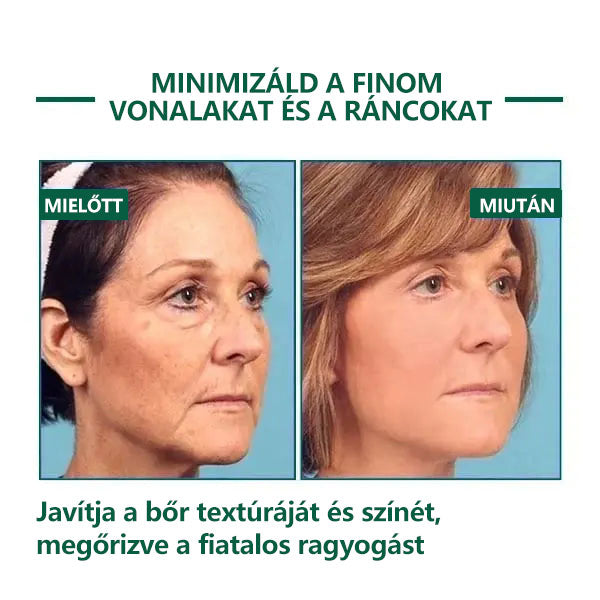 🌿💝A 60%-os akció utolsó napja - Fubsta™ öregedésgátló bőrfeszesítő szérum🔥