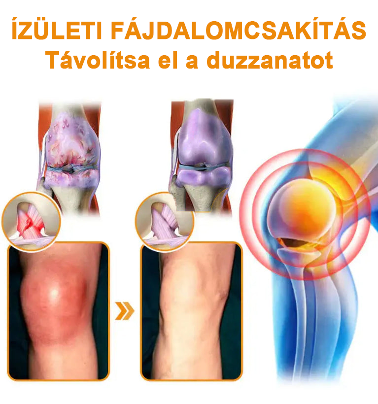 â
Hivatalos ĂruhĂĄz: Ourlyardâą MagnĂ©zium Olaj Ă©s MĂ©hmĂ©reg ĂzĂŒletjavĂtĂł spray đšââïž A GyĂłgyszerĂŒgyi Hivatal (OGYEI) jĂłvĂĄhagyĂĄsĂĄval.
