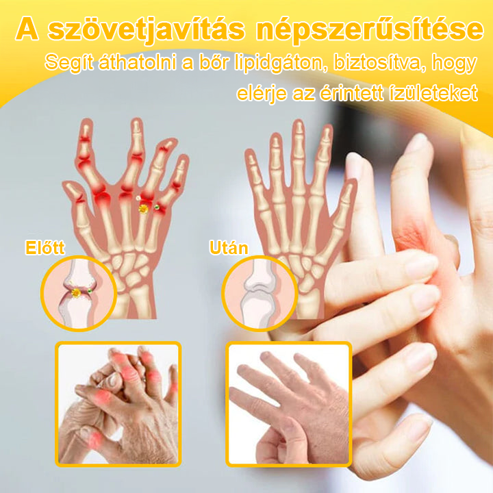 TLOPA® Botulinum Toxin és Méhméreg Fájdalomcsillapító Csontgyógyító Krém🐝 🔥(Kifejezetten időseknek & ortopéd szakorvosok ajánlásával)