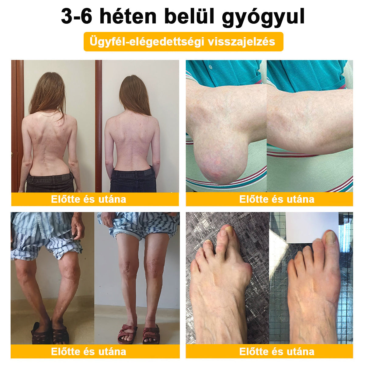 💧🐝TLOPA® Botulinum Toxin & Méhméreg Fájdalomcsillapító Csontgyógyító Krém👨⚕️A Magyar Ortopéd Társaság (MOT) Által Jóváhagyva