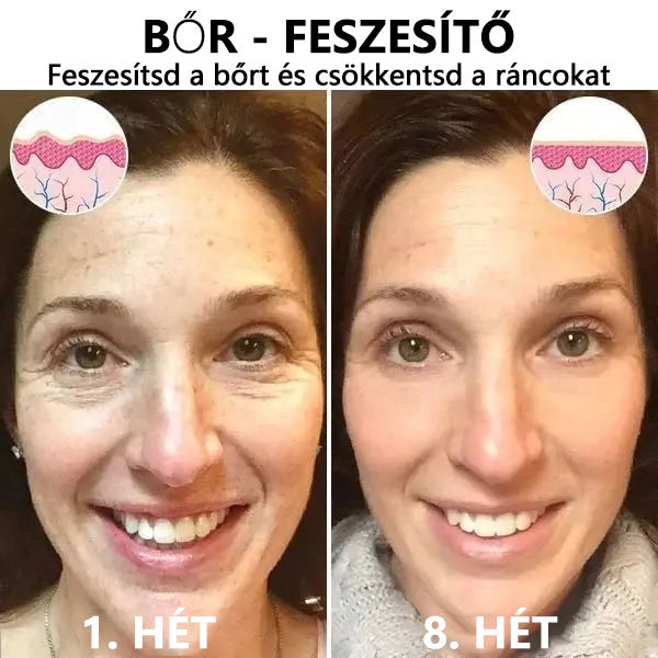 🌿💝A 60%-os akció utolsó napja - Fubsta™ öregedésgátló bőrfeszesítő szérum🔥