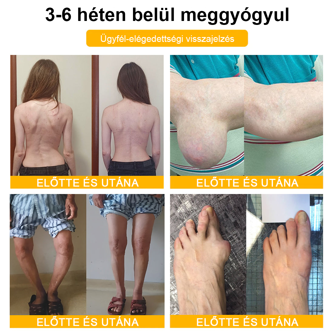 TLOPA® Botulinum Toxin és Méhméreg Fájdalomcsillapító Csontgyógyító Krém🐝 🔥(Kifejezetten időseknek & ortopéd szakorvosok ajánlásával)