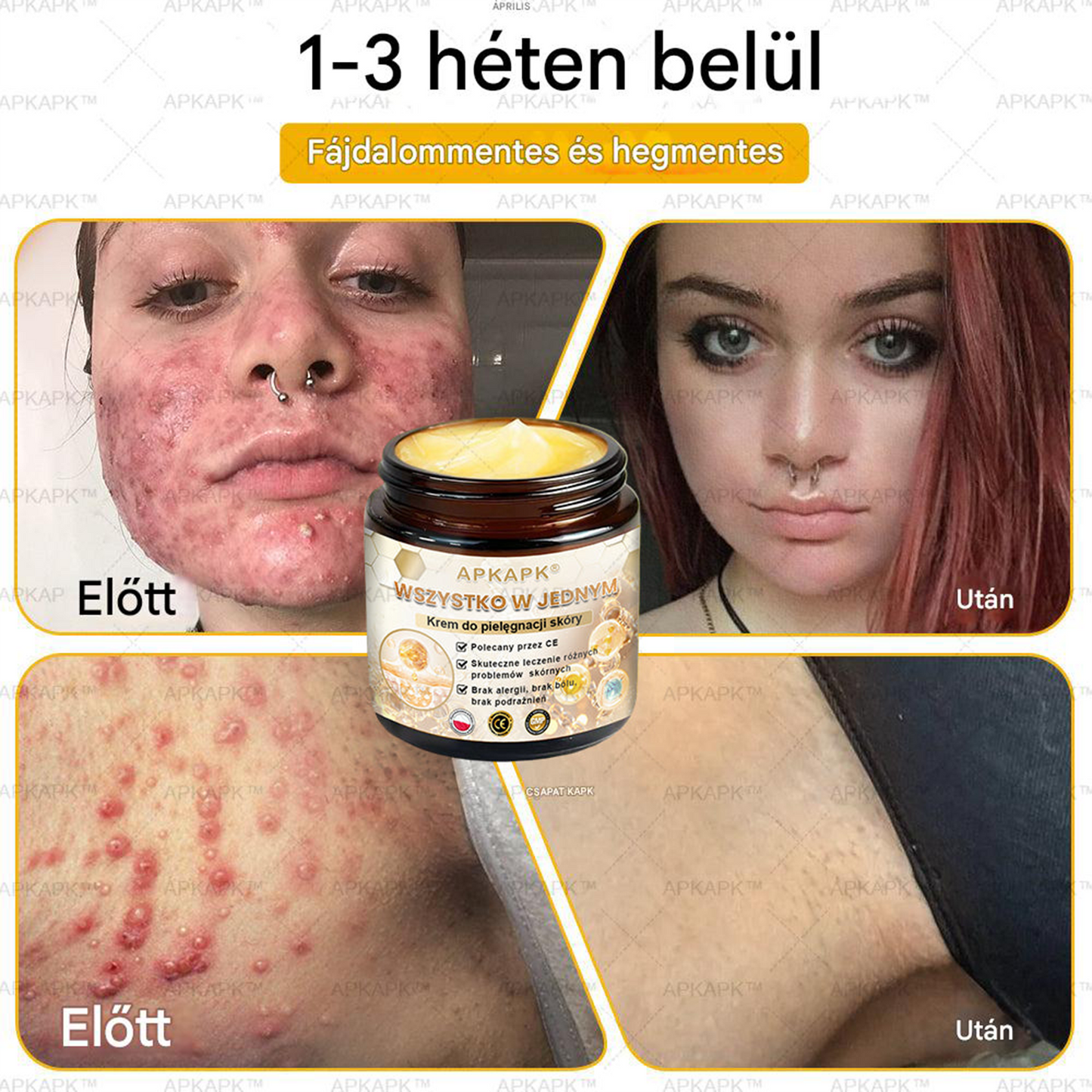 đšđ·đČđšđ·đČâą HatĂ©kony krĂ©m a teljes bĆrĂĄpolĂĄshozđ„