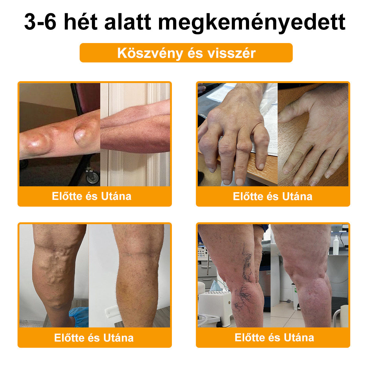 💧🐝TLOPA® Botulinum Toxin & Méhméreg Fájdalomcsillapító Csontgyógyító Krém👨⚕️A Magyar Ortopéd Társaság (MOT) Által Jóváhagyva