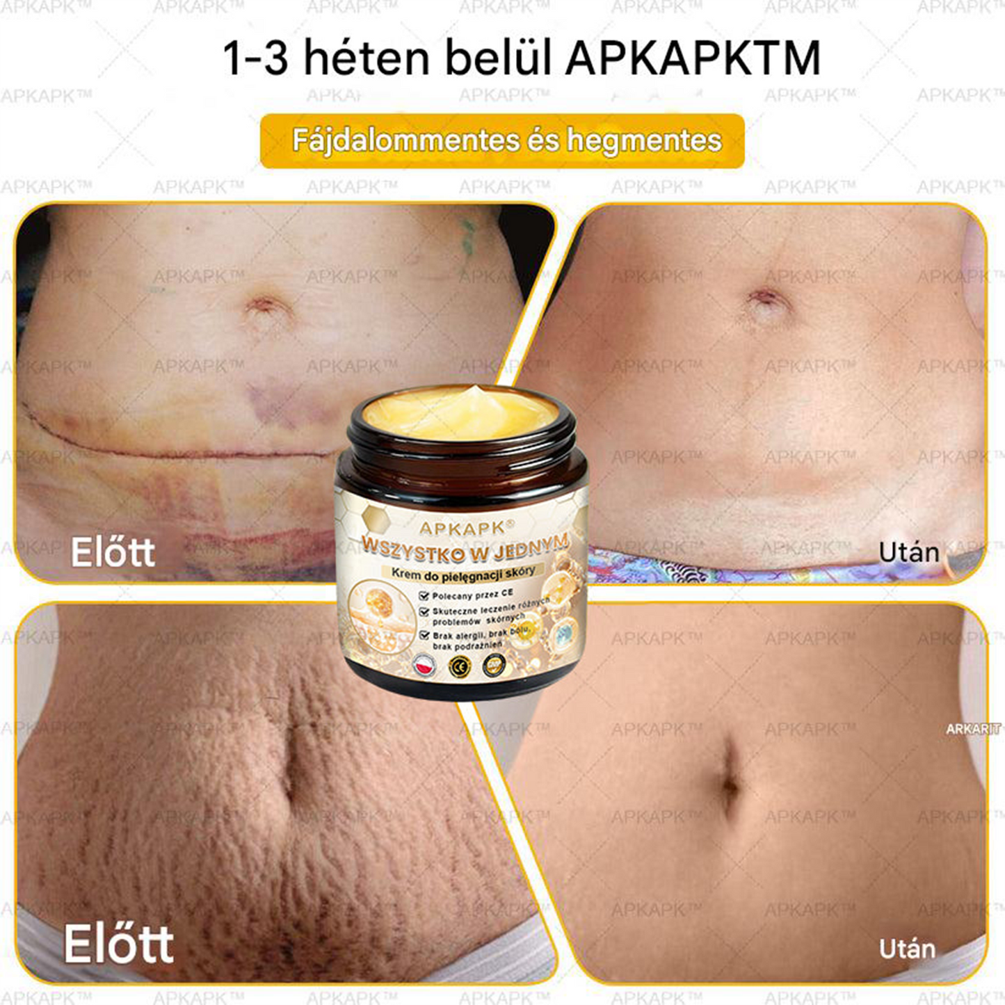 đšđ·đČđšđ·đČâą HatĂ©kony krĂ©m a teljes bĆrĂĄpolĂĄshozđ„
