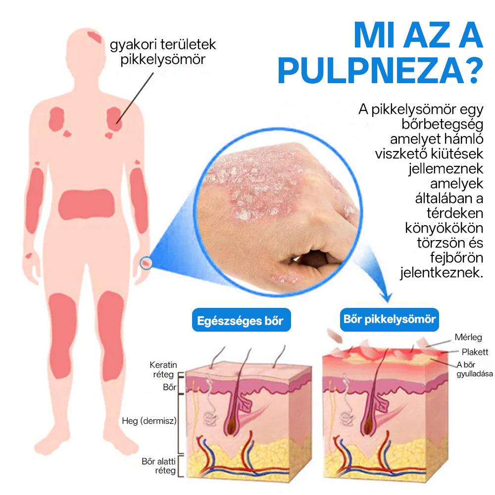 đ„đ„đ„ZvoevoÂź đMagnĂ©zium GyĂłgynövĂ©nyes PszoriĂĄzis Spray