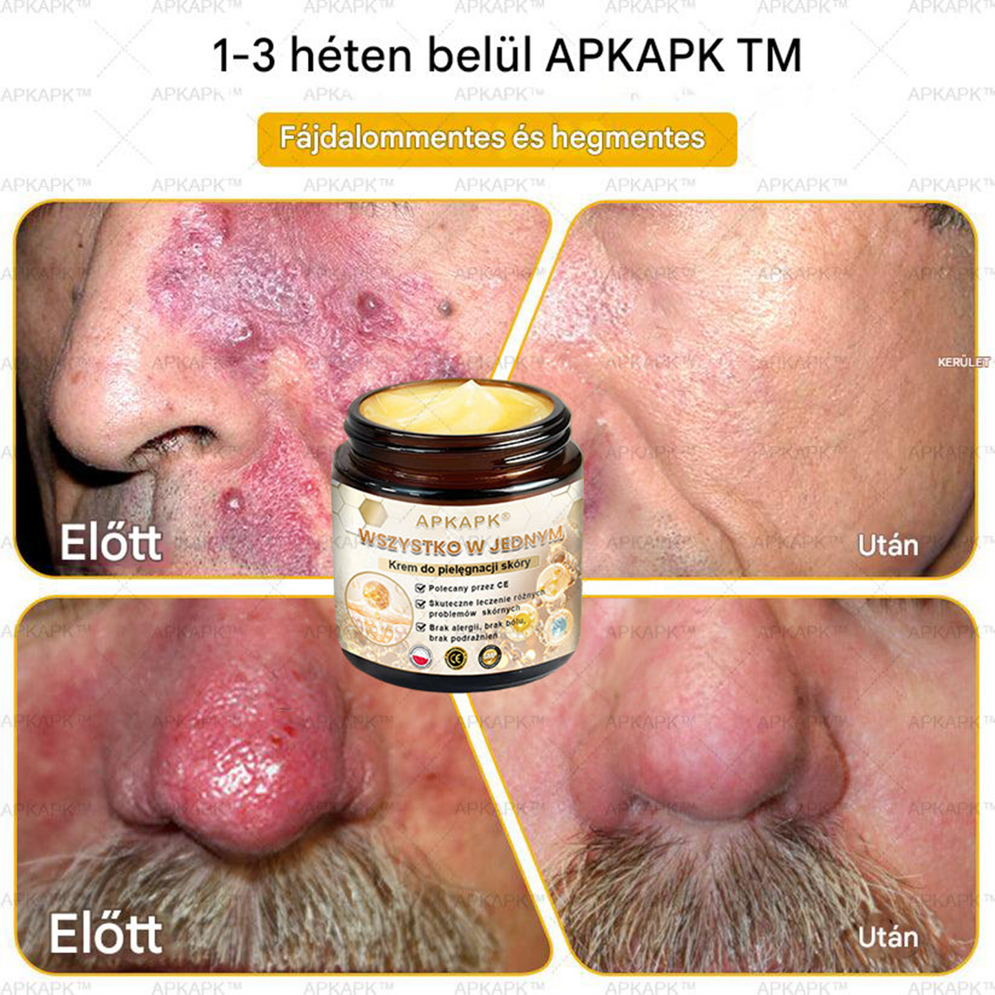đšđ·đČđšđ·đČâą HatĂ©kony krĂ©m a teljes bĆrĂĄpolĂĄshozđ„