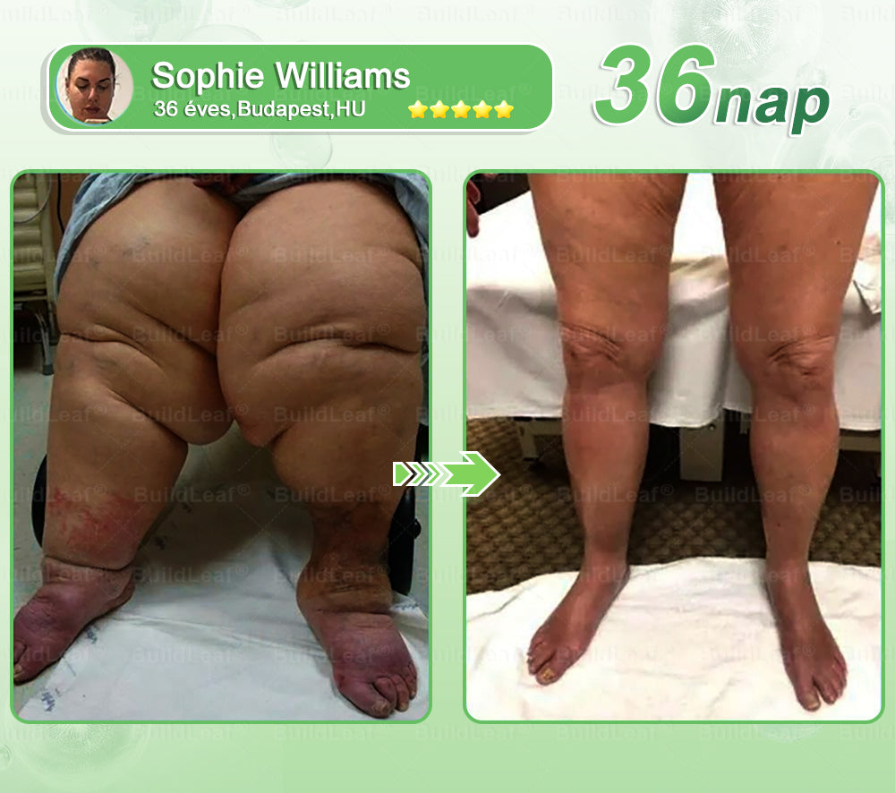 🌿BuildLeaf®🥇 GLP-1 8-az-1-ben Fit & Vital Orális Oldat (Csak napi egyszer, látható változások 7 nap alatt)  Elhízásra, szív- és érrendszeri egészségre, cukorbetegségre, alvási apnoéra, emésztőrendszeri egészségre, ízületi problémákra és még sok másra