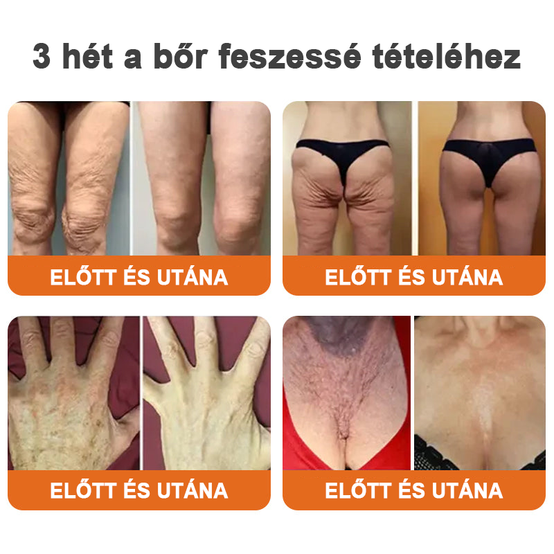 đKĂ©szĂŒlt Ă©s szĂĄllĂtott az EgyesĂŒlt KirĂĄlysĂĄgbĂłlâšEdiJonahâą Botox Bee Venom Firming Serum Stickđ„LAST DAY 70% OFFđ„
