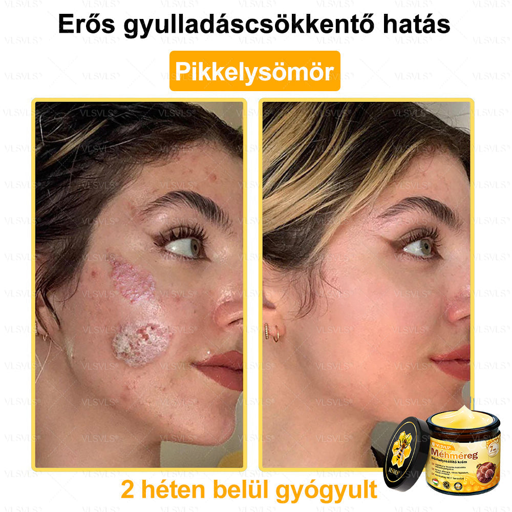 💪VLSVLS® Méhméreg Bőrhelyreállító Krém (👨⚕CE jóváhagyott)👍✅✅