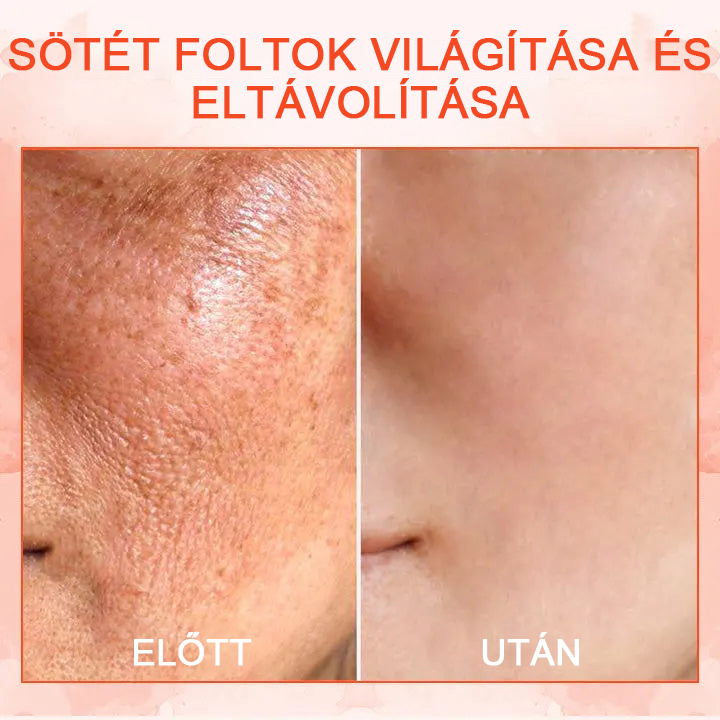 🌠✨75% 𝐑𝐀𝐁𝐀𝐓𝐓 ✨✨𝗖𝗼𝗼𝗹𝗼𝗿𝗱® - 𝐋𝐮𝐱𝐞𝐋𝐢𝐟𝐭 Feszesítő és tonizáló testápoló krémc✨🔥
