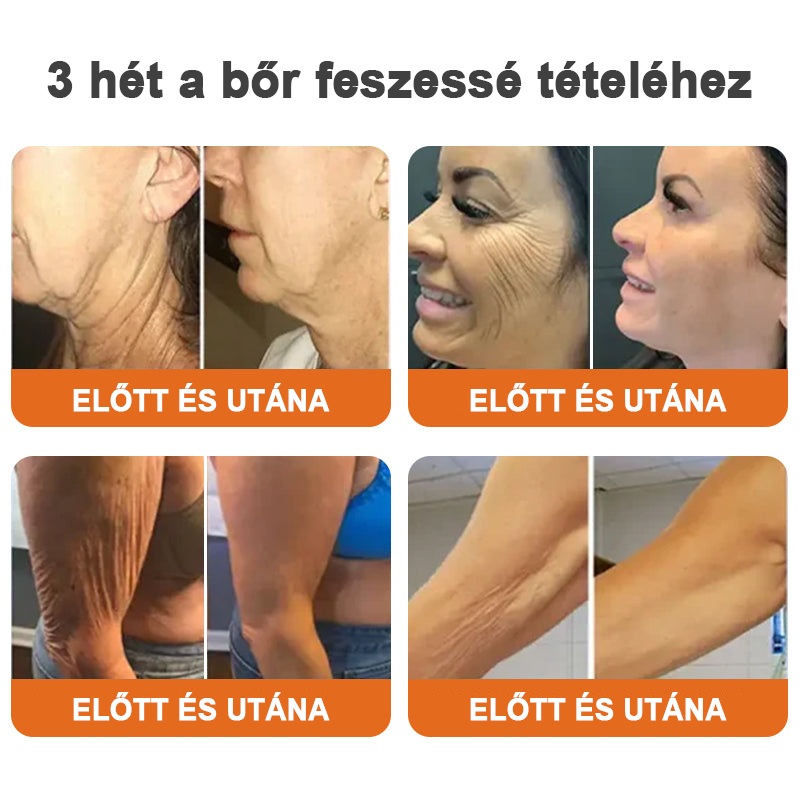 đKĂ©szĂŒlt Ă©s szĂĄllĂtott az EgyesĂŒlt KirĂĄlysĂĄgbĂłlâšEdiJonahâą Botox Bee Venom Firming Serum Stickđ„LAST DAY 70% OFFđ„