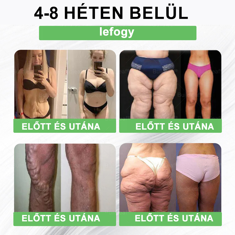 🌿BuildLeaf®🥇 GLP-1 8-az-1-ben Fit & Vital Orális Oldat (Csak napi egyszer, látható változások 7 nap alatt)  Elhízásra, szív- és érrendszeri egészségre, cukorbetegségre, alvási apnoéra, emésztőrendszeri egészségre, ízületi problémákra és még sok másra