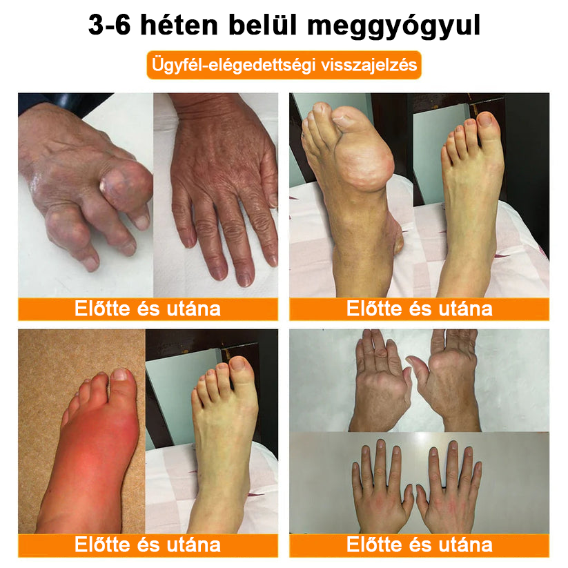 â
Hivatalos ĂruhĂĄz: Ourlyardâą MagnĂ©zium Olaj Ă©s MĂ©hmĂ©reg ĂzĂŒletjavĂtĂł spray đšââïž A GyĂłgyszerĂŒgyi Hivatal (OGYEI) jĂłvĂĄhagyĂĄsĂĄval.