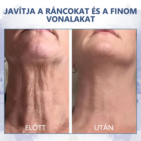 đ«§UtolsĂł napi kedvezmĂ©ny: 80% kedvezmĂ©nyđ«§FubstaÂź Advanced Firming & Anti-Wrinkle Cream: helyreĂĄllĂtja a bĆr rugalmassĂĄgĂĄtđ«§