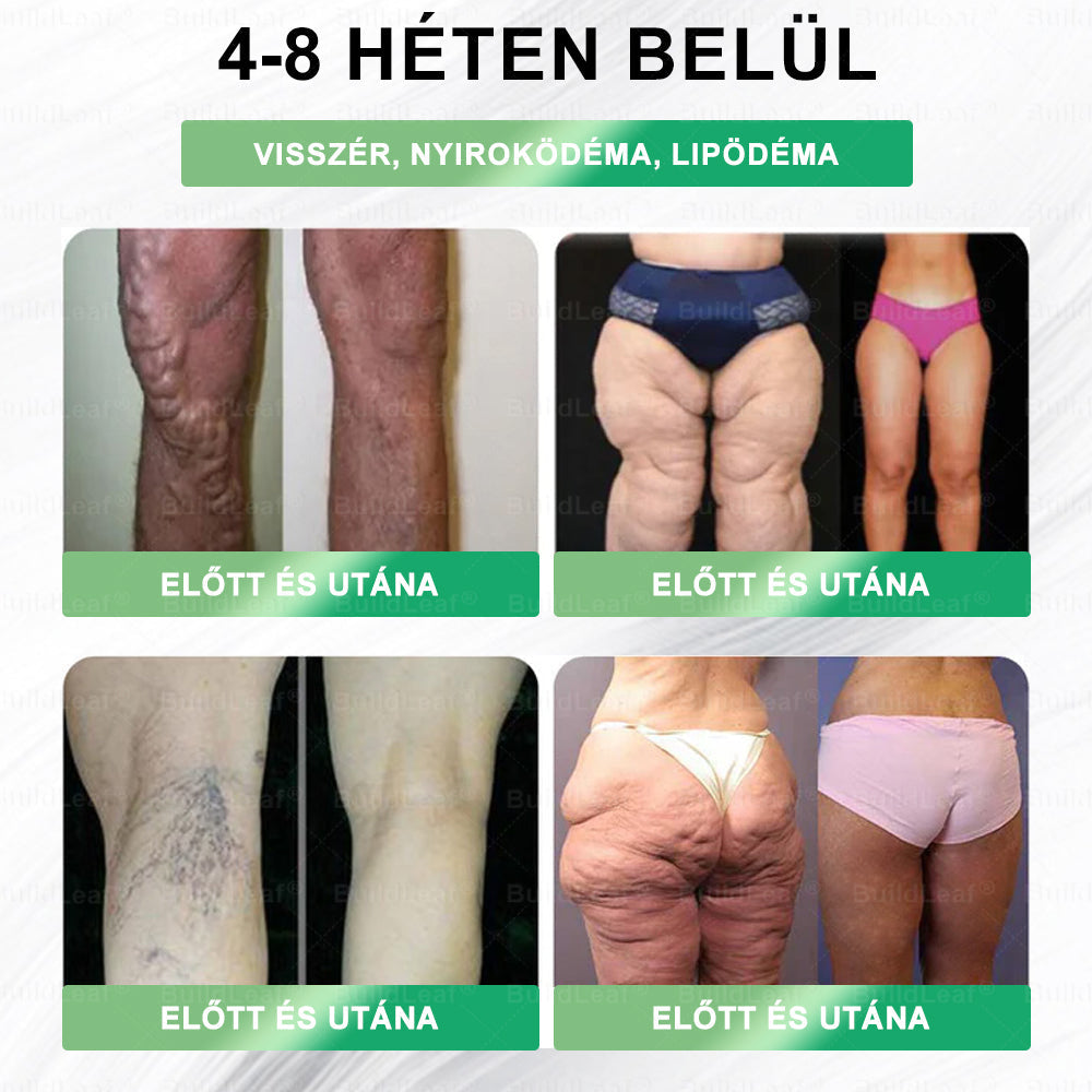 🌿BuildLeaf®🥇 GLP-1 8-az-1-ben Fit & Vital Orális Oldat (Csak napi egyszer, látható változások 7 nap alatt)  Elhízásra, szív- és érrendszeri egészségre, cukorbetegségre, alvási apnoéra, emésztőrendszeri egészségre, ízületi problémákra és még sok másra