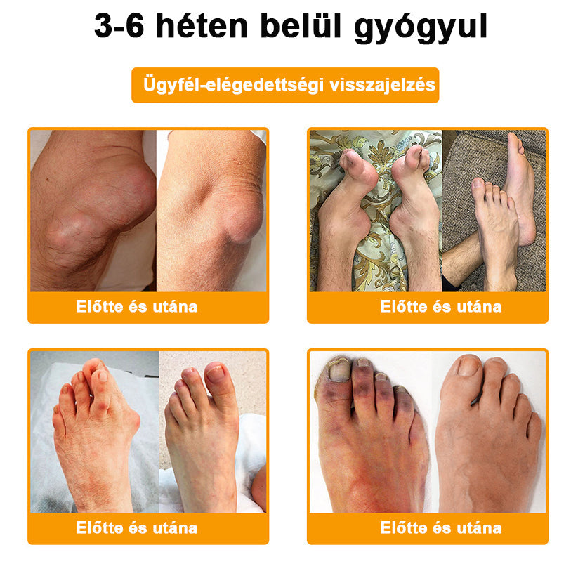 💧🐝TLOPA® Botulinum Toxin & Méhméreg Fájdalomcsillapító Csontgyógyító Krém👨⚕️A Magyar Ortopéd Társaság (MOT) Által Jóváhagyva