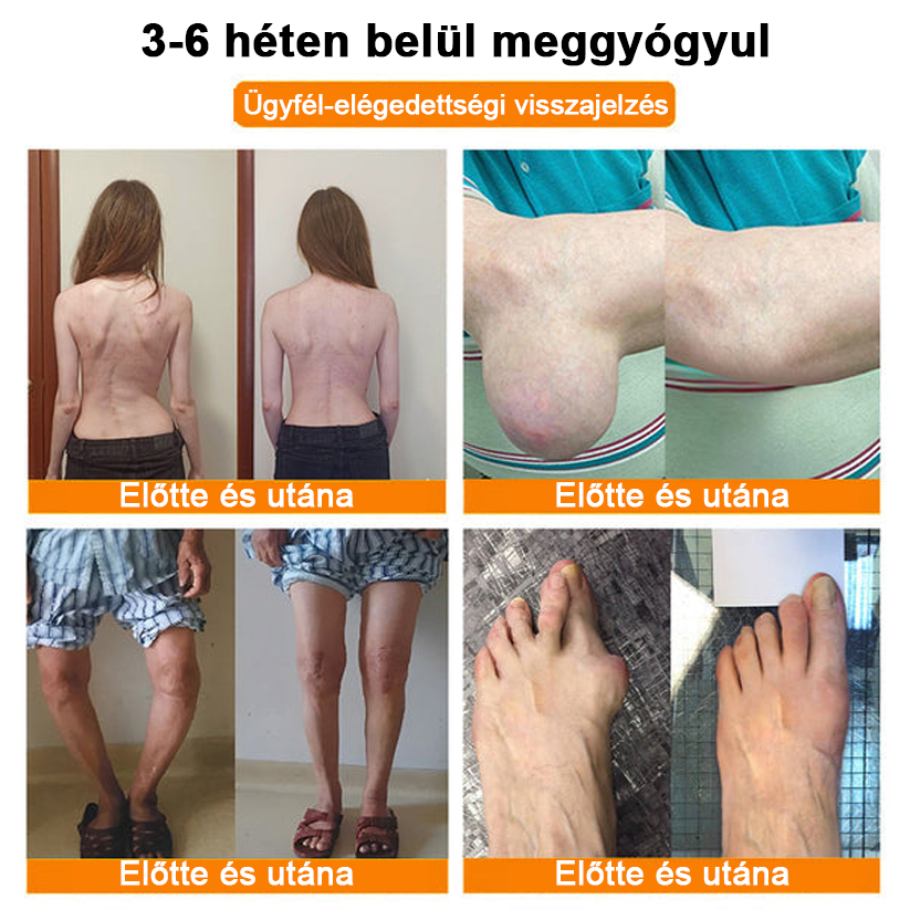 â
Hivatalos ĂruhĂĄz: Ourlyardâą MagnĂ©zium Olaj Ă©s MĂ©hmĂ©reg ĂzĂŒletjavĂtĂł spray đšââïž A GyĂłgyszerĂŒgyi Hivatal (OGYEI) jĂłvĂĄhagyĂĄsĂĄval.