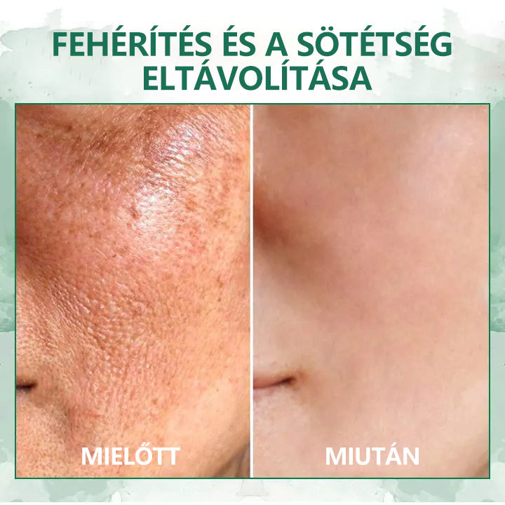 🌿💝A 60%-os akció utolsó napja - Fubsta™ öregedésgátló bőrfeszesítő szérum🔥