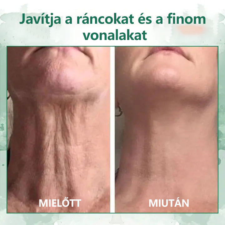 🌿💝A 60%-os akció utolsó napja - Fubsta™ öregedésgátló bőrfeszesítő szérum🔥