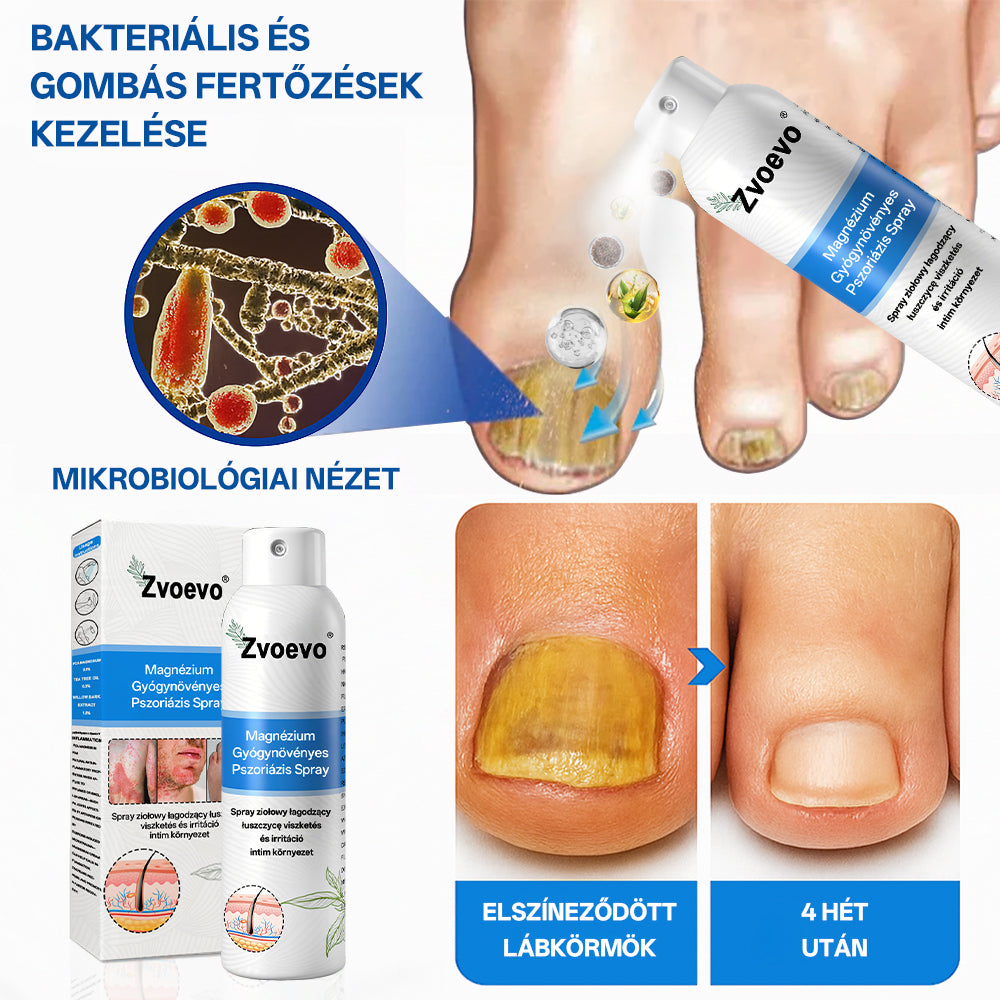 đ„đ„đ„ZvoevoÂź đMagnĂ©zium GyĂłgynövĂ©nyes PszoriĂĄzis Spray