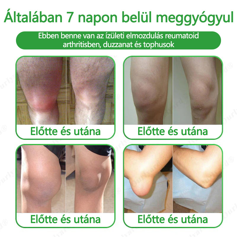 👨⚕️✅Ourlyard® Advanced Magnesium & Emu Oil Massage Pain Relief Cream (🏅A végső megoldás izomfájdalmak, ízületi gyulladás, ízületi fájdalom, idegfájdalom, gyulladás és merevség esetén) – Gyártva az USA-ban