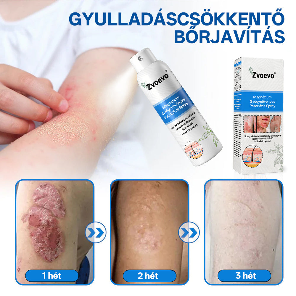 đ„đ„đ„ZvoevoÂź đMagnĂ©zium GyĂłgynövĂ©nyes PszoriĂĄzis Spray