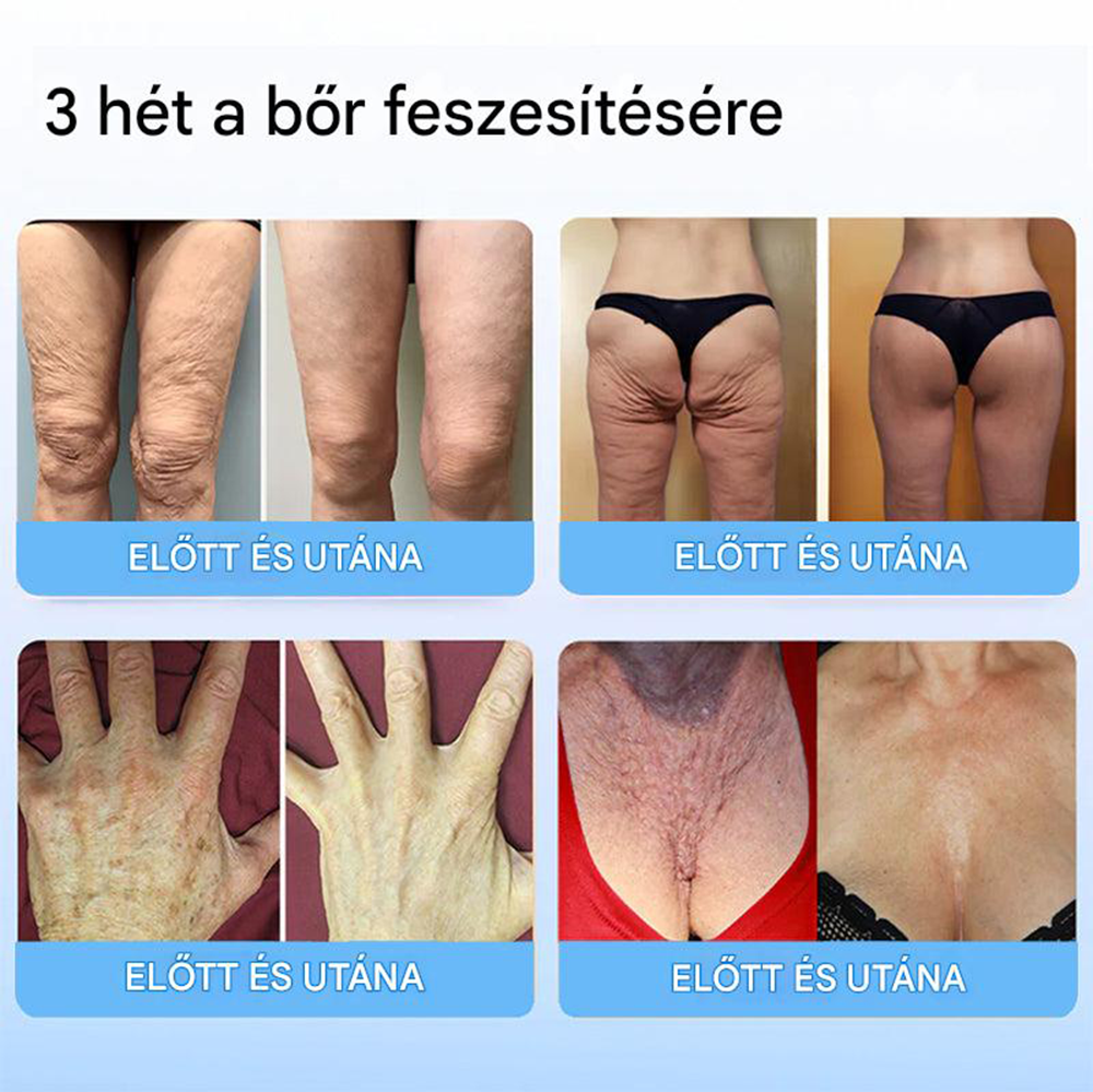 TLOPA™ Collagen Peptide Firming Serum Stick 🎄🎄 - Az Országos Közegészségügyi és Gyógyszerészeti Központ (NCPHP) és a Magyar Bőrgyógyászati Társaság (MDT) a legmagasabb minőségi és biztonsági garanciát nyújtja bőrének. 🔥