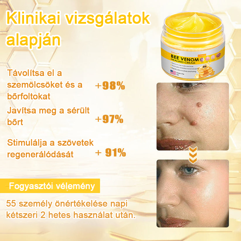 2024 ÚJ Velisse™ méhméreg bőrkrém(🧑⚕️AAD ajánlott), a szemölcsök, akné és hegek eltávolítására – többféle bőrbetegség kezelésére