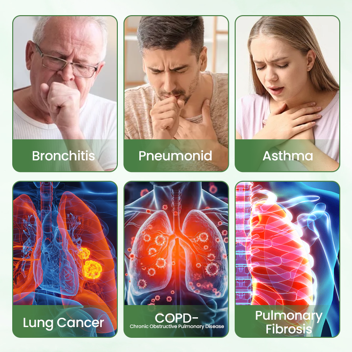 ✅Timilk® LungPure gyógynövényes méregtelenítő inhalátor