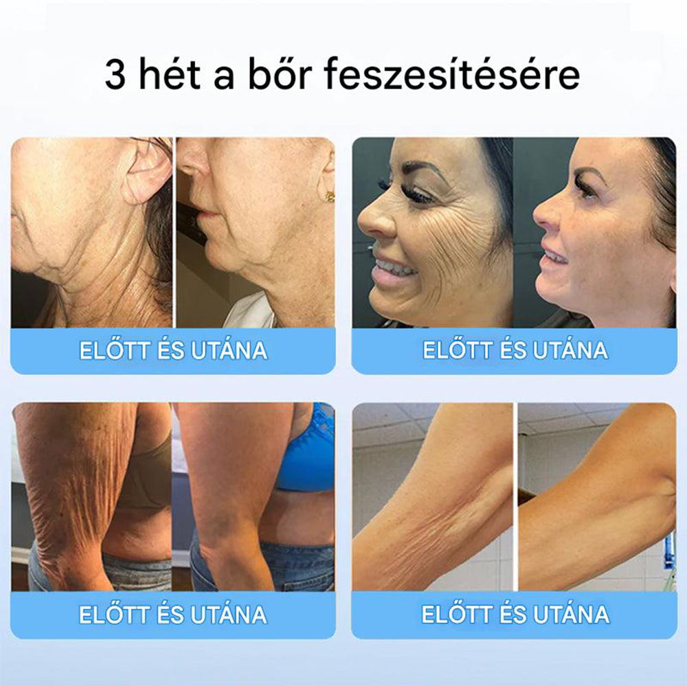 TLOPA™ Collagen Peptide Firming Serum Stick 🎄🎄 - Az Országos Közegészségügyi és Gyógyszerészeti Központ (NCPHP) és a Magyar Bőrgyógyászati Társaság (MDT) a legmagasabb minőségi és biztonsági garanciát nyújtja bőrének. 🔥