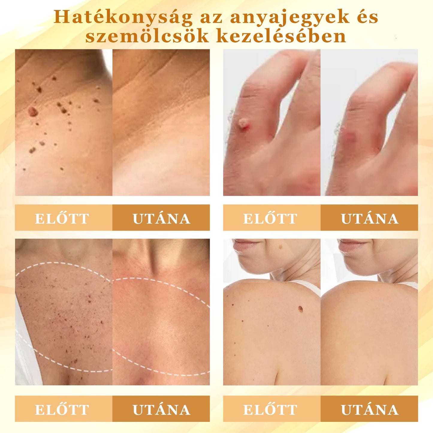 Croaie® Mellifera-méreg sűrítése bőrregeneráló krém💖