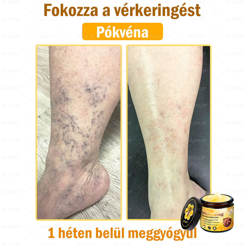 💪VLSVLS® Méhméreg Bőrhelyreállító Krém (👨‍⚕‍CE jóváhagyott)👍✅