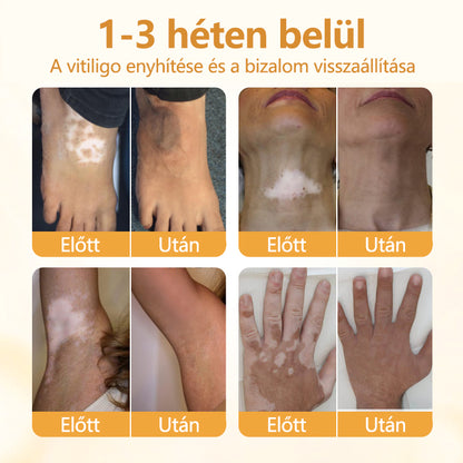 Timilk® VitiCalm méhméreg-krém🌻