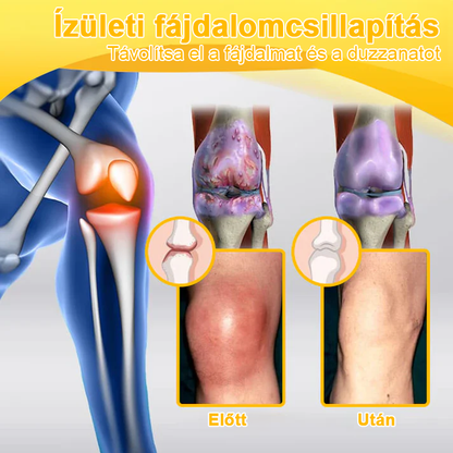 TLOPA® Botulinum Toxin és Méhméreg Fájdalomcsillapító Csontgyógyító Krém🐝 🔥(Kifejezetten időseknek & ortopéd szakorvosok ajánlásával)
