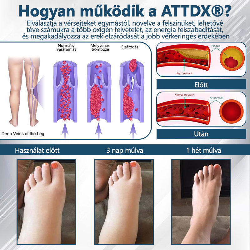 👨‍⚕️👨‍⚕️👨‍⚕️ATTDX® Növényi ödéma enyhítő krém nigellával