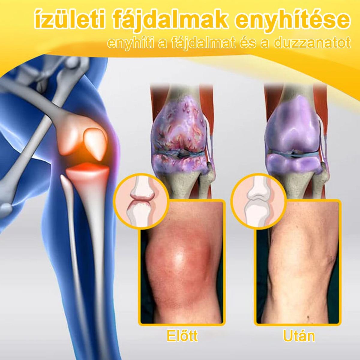 𝐀𝐫𝐭𝐡𝐫𝐨𝐅𝐫𝐞𝐞™Méhméreg fájdalomcsillapító csontgyógyító krém(Különösen az idősebb felnőtteknek és a DGOU által ajánlott) ✨Különleges ajánlat korlátozott ideig✨