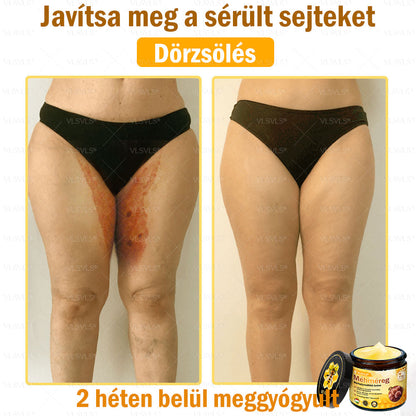 💪VLSVLS® Méhméreg Bőrhelyreállító Krém (👨‍⚕‍CE jóváhagyott)👍✅