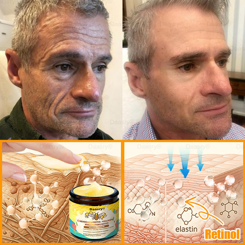 Daasry® Méhméreg Krém – Természetes bőrfeszesítés és ránctalanítás klinikai hatékonysággal! ✨
