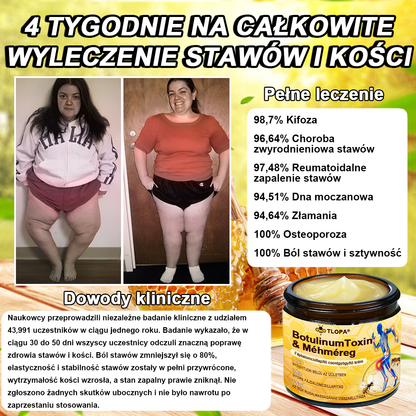 TLOPA® Botulinum Toxin és Méhméreg Fájdalomcsillapító Csontgyógyító Krém🐝 🔥(Kifejezetten időseknek & ortopéd szakorvosok ajánlásával)