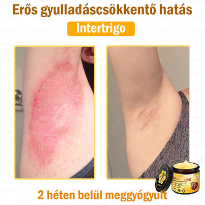 💪VLSVLS® Méhméreg Bőrhelyreállító Krém (👨‍⚕‍CE jóváhagyott)👍✅