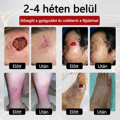 ⭐ATTDX® GlucoseGuard bőrmentő krém