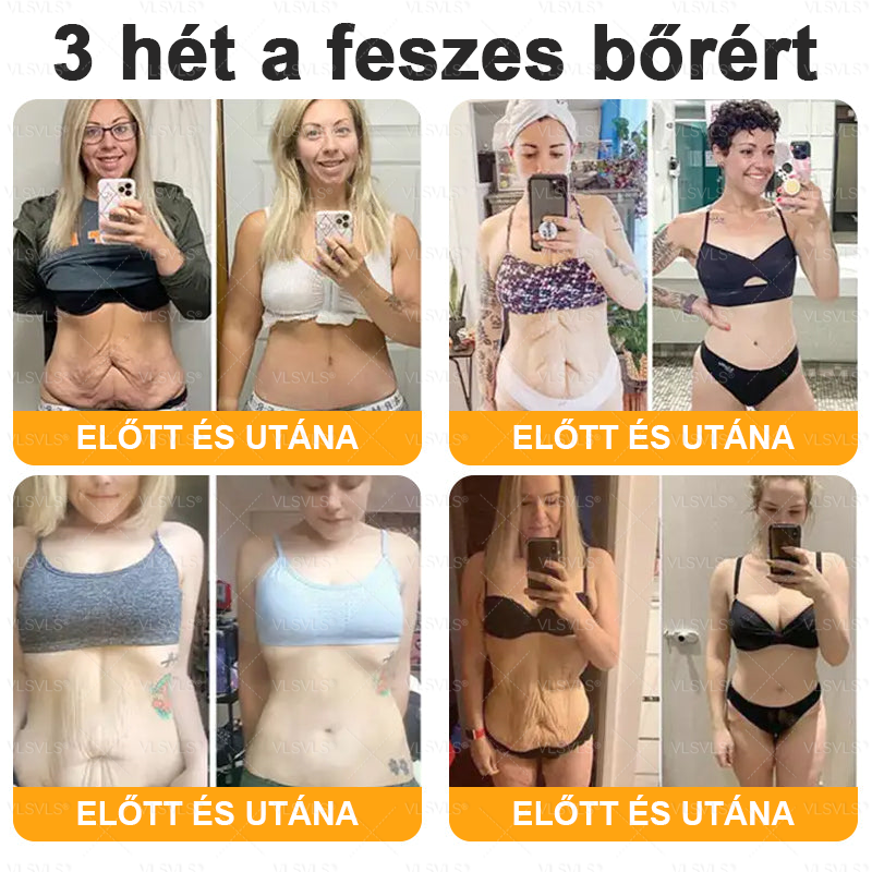 ✨✨✨✨VLSVLS® Méhméreg Átfogó Krém (Minden korosztály számára alkalmas & HSME ajánlja)