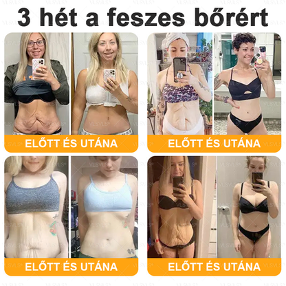 ✨✨✨✨VLSVLS® Méhméreg Átfogó Krém (Minden korosztály számára alkalmas & HSME ajánlja)