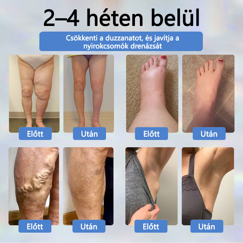 👨‍⚕️👨‍⚕️👨‍⚕️ATTDX® Növényi ödéma enyhítő krém nigellával