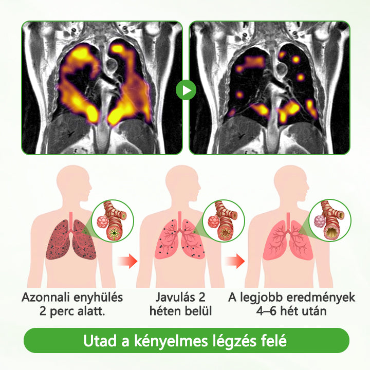 ATTDX® Mulleaf gyógynövényes tüdőtisztító🌿🌿