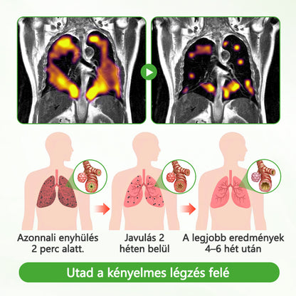 ATTDX® Mulleaf gyógynövényes tüdőtisztító🌿🌿